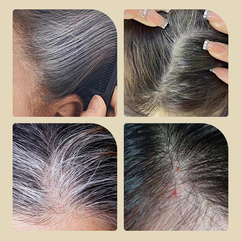 🥰 BUY 1 GET 1 FREE!!🥰Safe and Convenient Comb Hair Dye