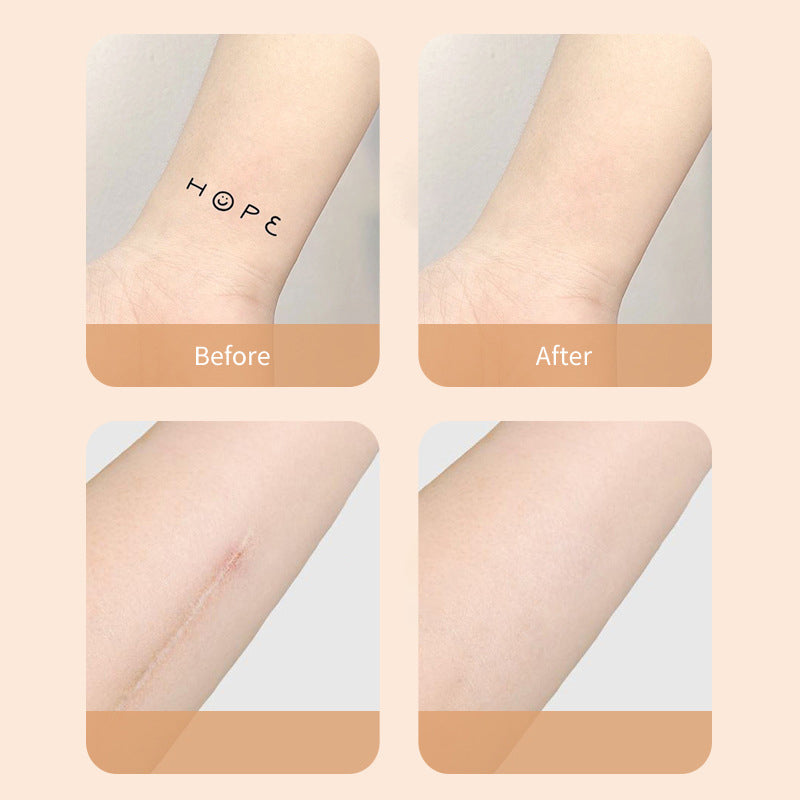🔥BIG SALE BUY 5 GET 5 FREE🔥Ultra-Thin Tattoo and Scar Concealer Patch