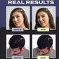 💖Limited Sale 50% OFF💖Hair Building Fibers Set for Thinning Hair & Bald Spots