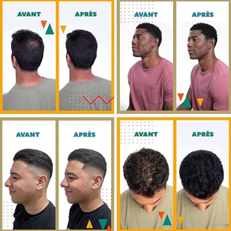 💖Limited Sale 50% OFF💖Hair Building Fibers Set for Thinning Hair & Bald Spots