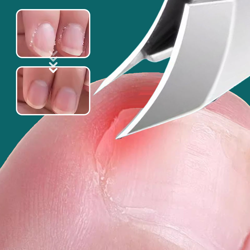 🔥Last Day 50% OFF🔥Anti-Splash 25° Slant Edge Nail Clipper 3-Piece Set